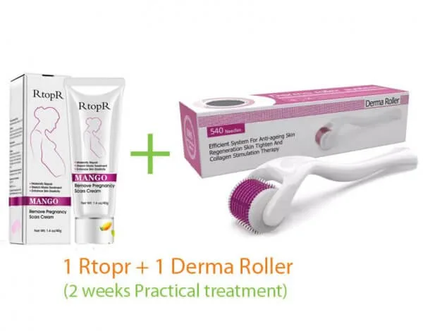 Rtopr Stretch Mark Cream 1Pcs + Derma Roller (2 weeks Practical Treatment)