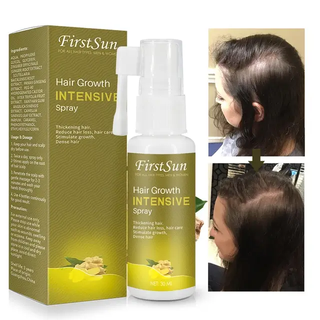 2 Weeks Intensive Hair Growth Treatment (Contains 1 Intensive Hair Spray +  1 Derma Roller) » SkinOl Cosmetics