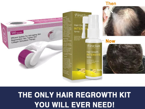 THE ONLY HAIR REGROWTH KIT YOU WILL EVER NEED