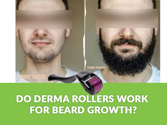 Derma roller for beard before and after