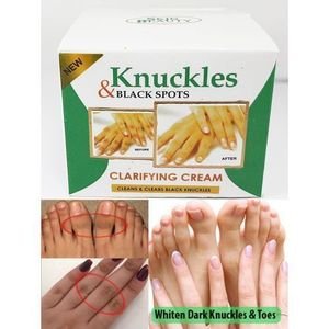 Knuckles and black spot clarifying cream